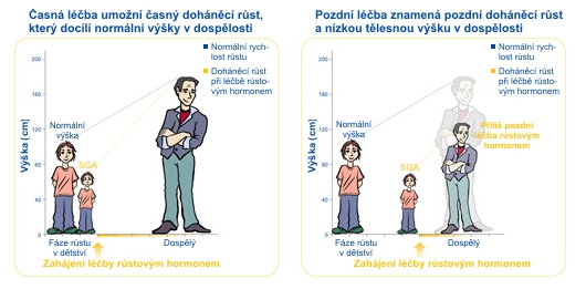 Včasné a pozdní zahájení léčby růstovým hormonem 